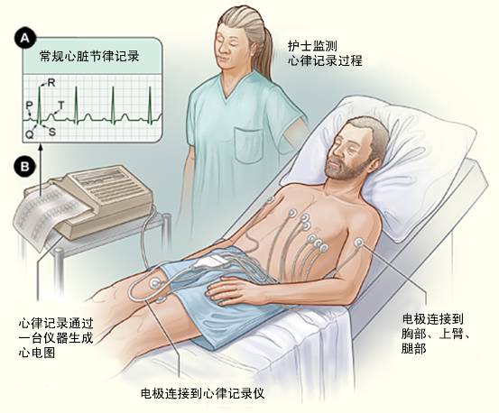 冠心病需要做哪些检查？(图1)